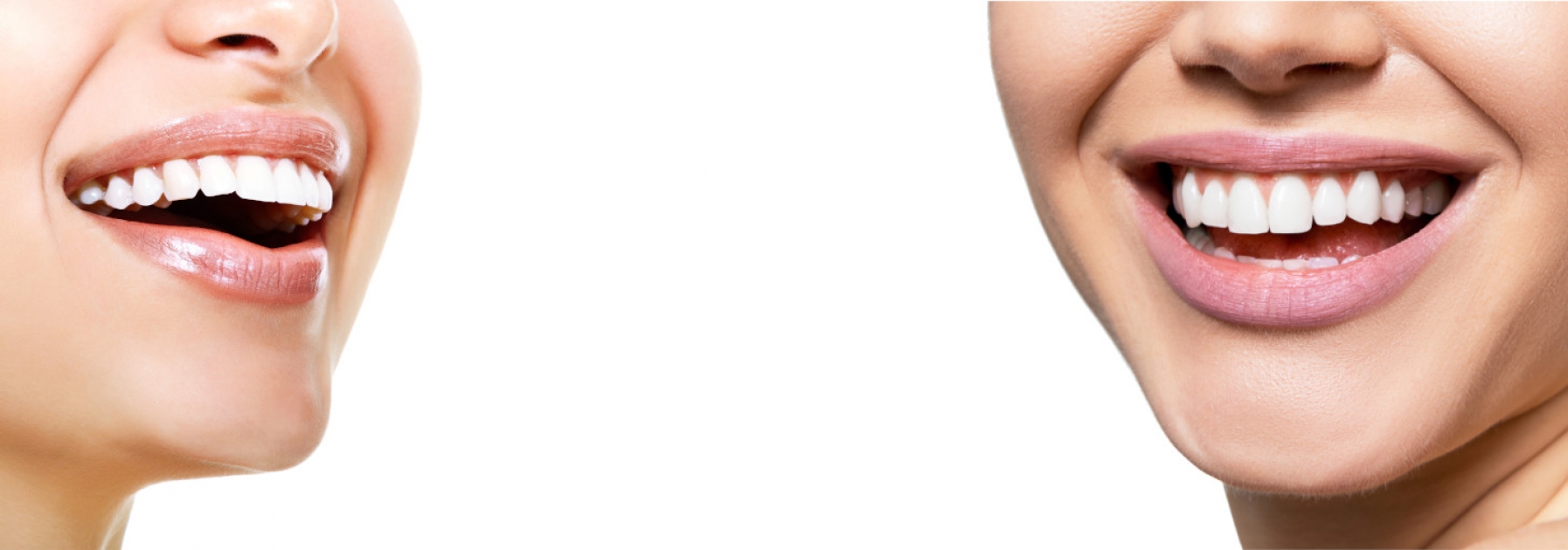 Zabieg pozwala na usunięcie osadu oraz przebarwień powstałych na skutek niewłaściwej pielęgnacji, palenia papierosów oraz spożywania produktów o intensywnym zabarwieniu; herbata, wino, soki.
Dowiedz się więcej...  Wyślij wiadomość